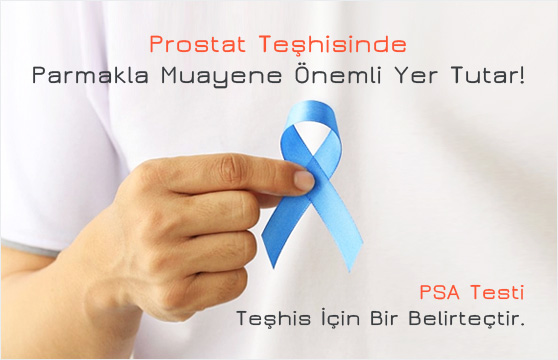 Prostat Tanısı